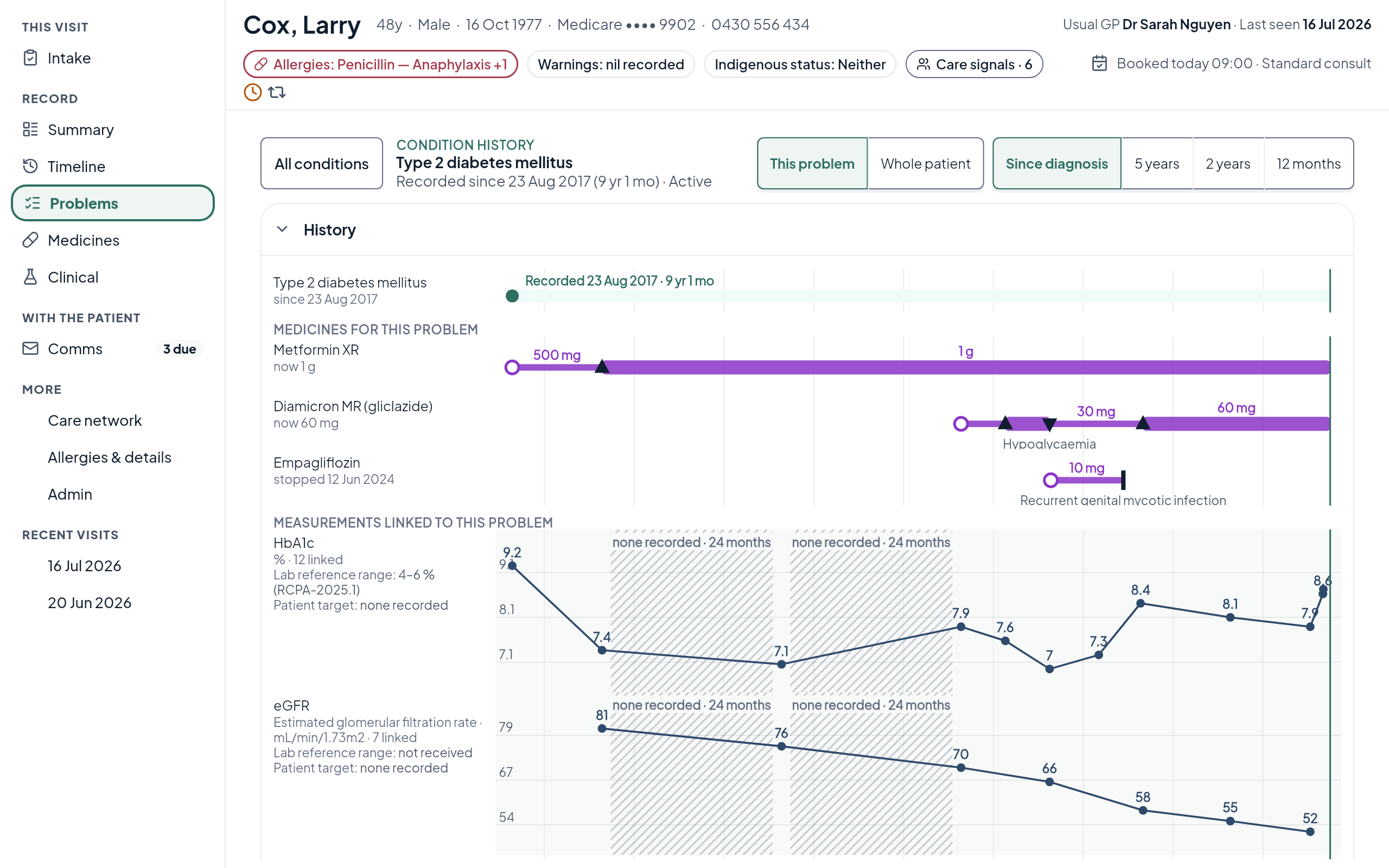 Larry's diabetes history: metformin and gliclazide lanes with each dose change, above his HbA1c results on one timeline.